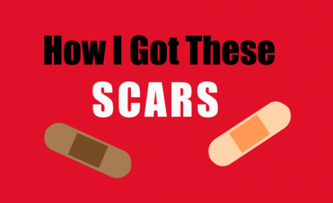 How I Got These Scars